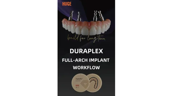 Протокол имплантации полной дуги с DuraPlex PMMA и Gumimic